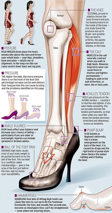 Using Lidocaine To Lessen Pain From Wearing Heels Is Going Viral, But Is It  Actually Safe?