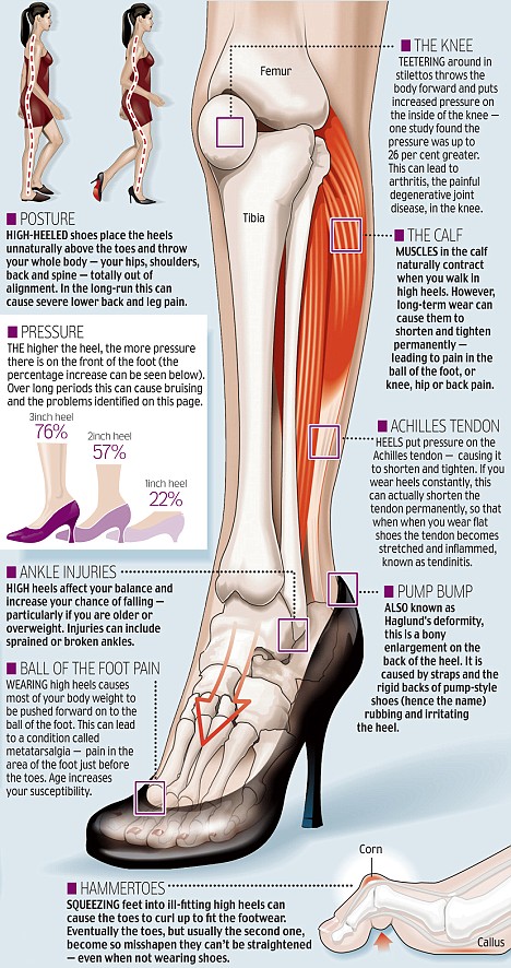 How Wearing High Heels Causes Pain