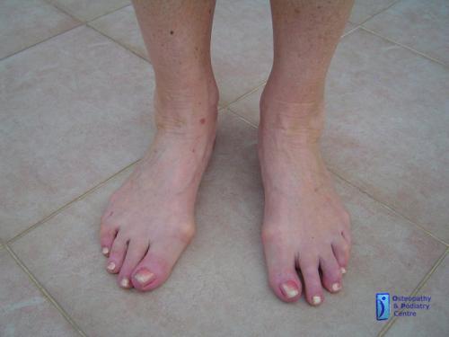 phoca thumb l grannies-feet